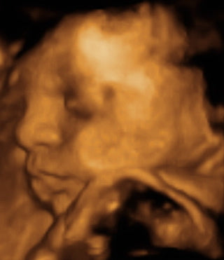 Pregnancy Week image