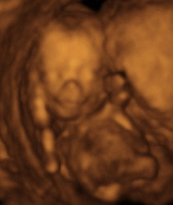 Pregnancy Week image