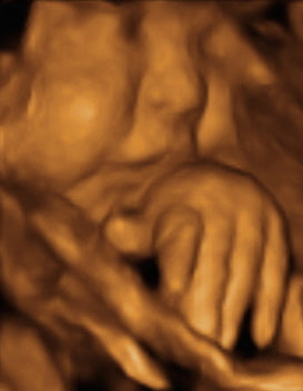 Pregnancy Week image