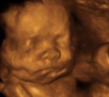 Pregnancy Week image