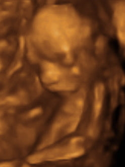 Pregnancy Week image