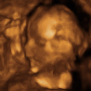 Pregnancy Week image