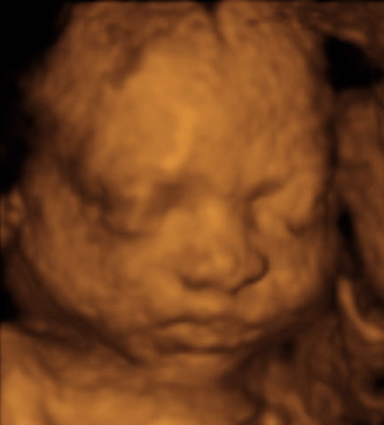 Pregnancy Week image