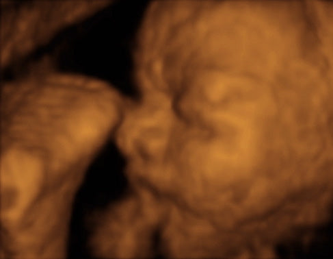 Pregnancy Week image