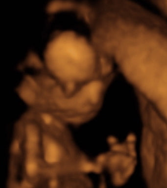 Pregnancy Week image