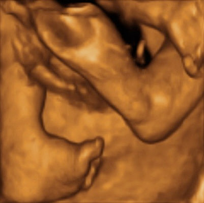 Pregnancy Week image