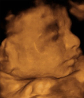 Pregnancy Week image