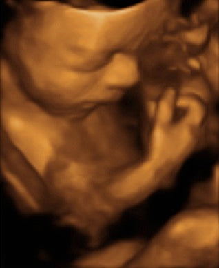 Pregnancy Week image