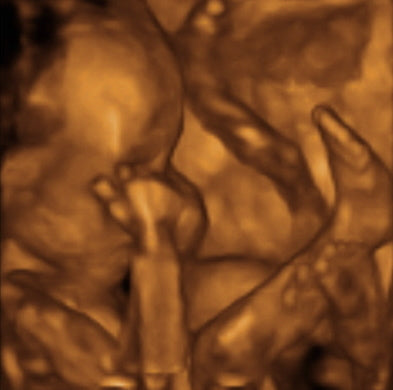 Pregnancy Week image