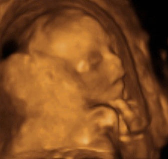 Pregnancy Week image