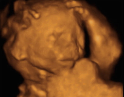 Pregnancy Week image