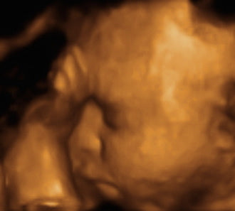 Pregnancy Week image