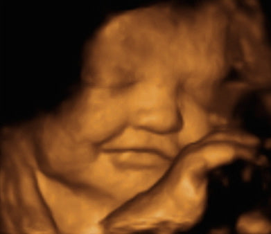 Pregnancy Week image