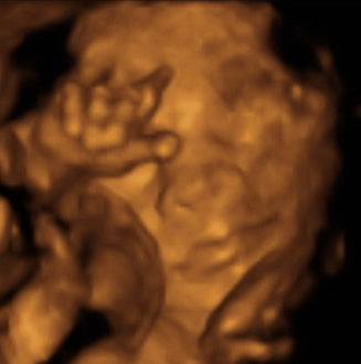 Pregnancy Week image