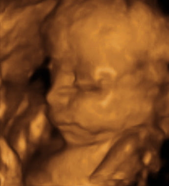 Pregnancy Week image