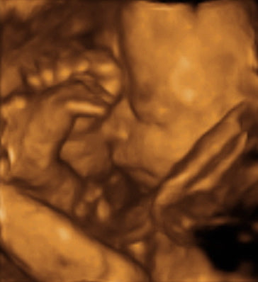 Pregnancy Week image
