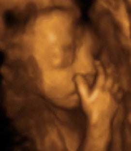 Pregnancy Week image