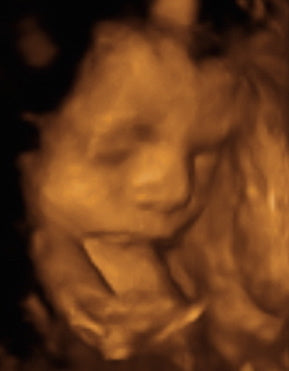 Pregnancy Week image