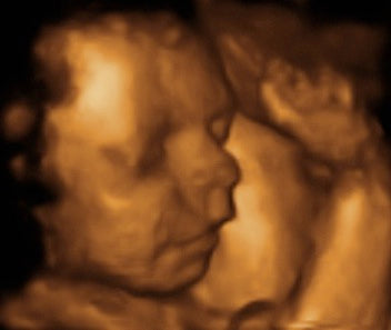 Pregnancy Week image