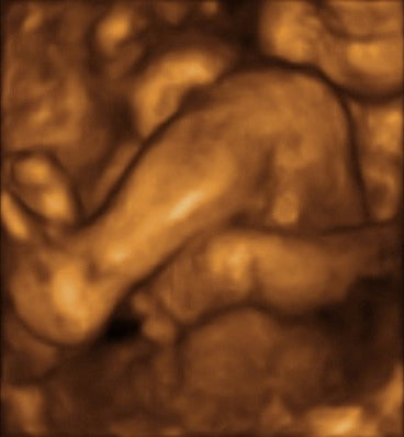 Pregnancy Week image