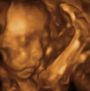 Pregnancy Week image