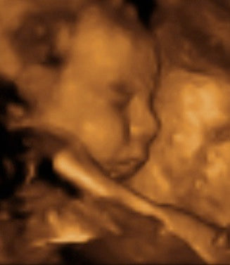 Pregnancy Week image