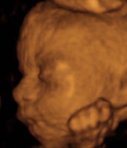 Pregnancy Week image