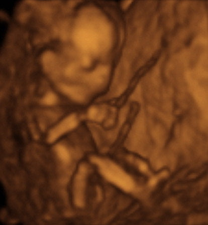 Pregnancy Week image