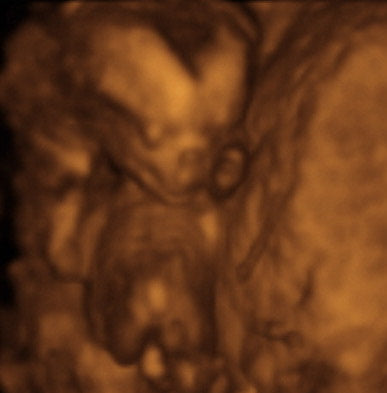 Pregnancy Week image