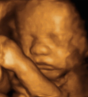 Pregnancy Week image