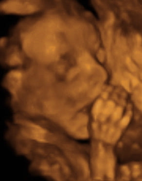 Pregnancy Week image
