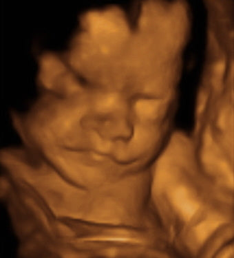 Pregnancy Week image
