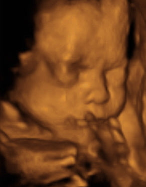 Pregnancy Week image