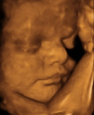 Pregnancy Week image