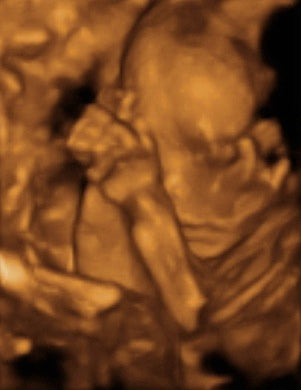 Pregnancy Week image