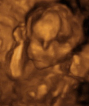 Pregnancy Week image