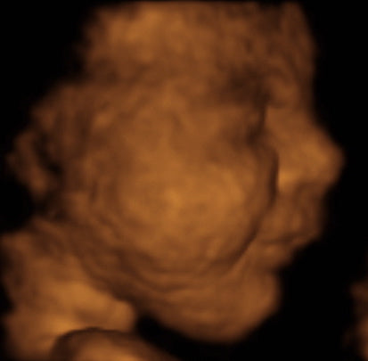 Pregnancy Week image