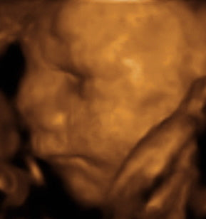 Pregnancy Week image