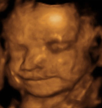 Pregnancy Week image