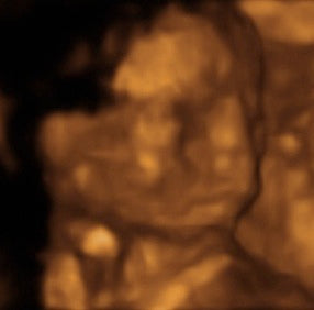 Pregnancy Week image