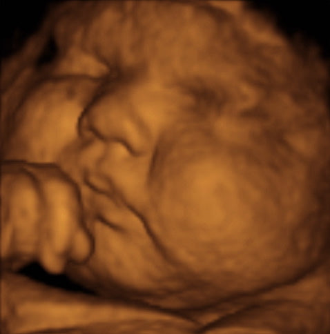 Pregnancy Week image