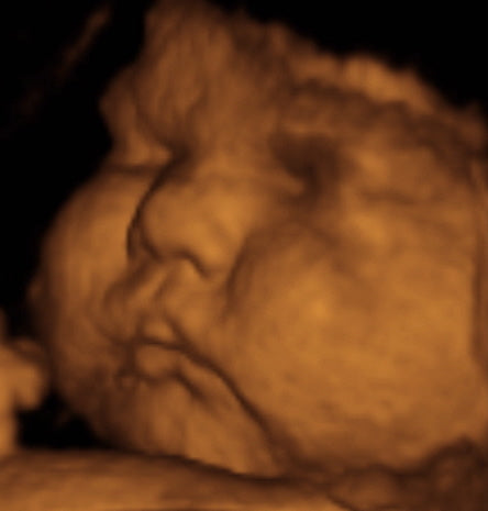 Pregnancy Week image