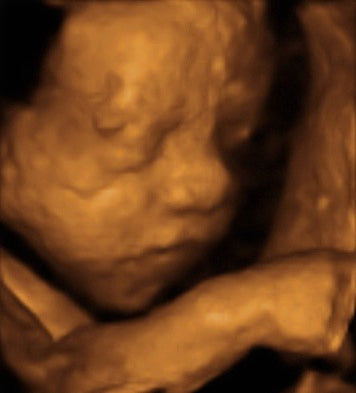 Pregnancy Week image