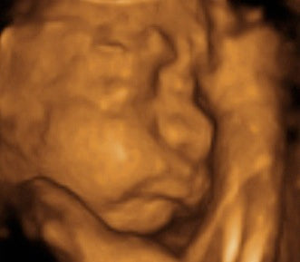 Pregnancy Week image