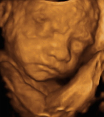Pregnancy Week image