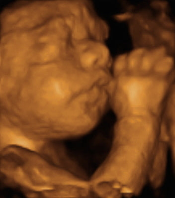 Pregnancy Week image