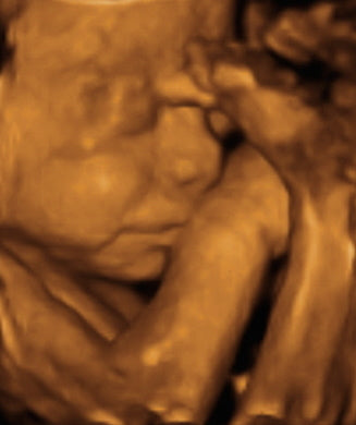Pregnancy Week image