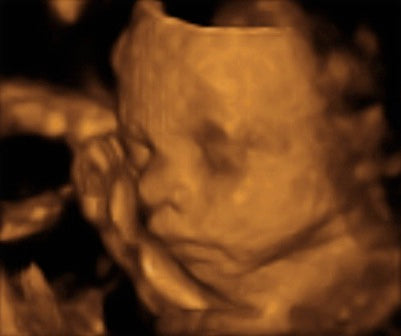 Pregnancy Week image