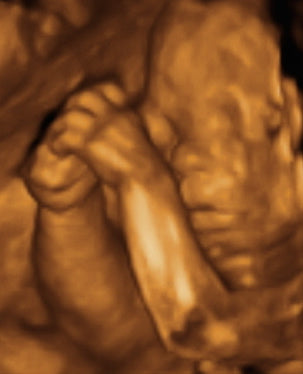 Pregnancy Week image