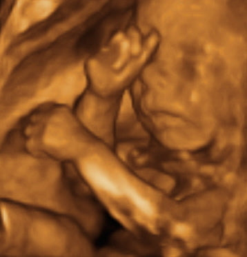 Pregnancy Week image